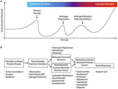 Prostate Cancer Theranostics - An Overview